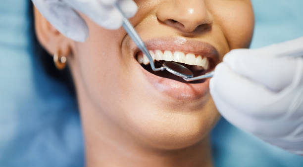 Best Emergency Dentist for Special Needs Patients in Reminderville, OH